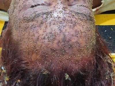 (Picture)..woman died from massive amounts of BEE stings!