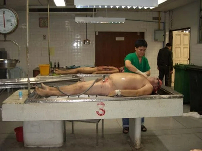 A collection of autopsies of various men