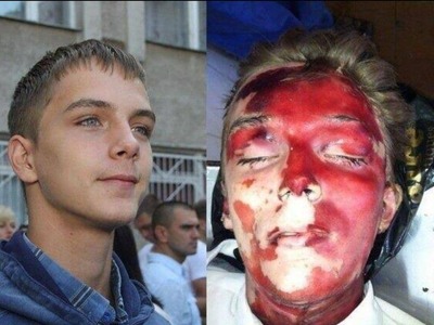Uncensored Images of the Odessa Massacre