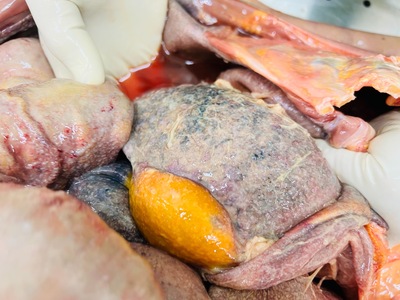 Autopsy, necrotic tissue