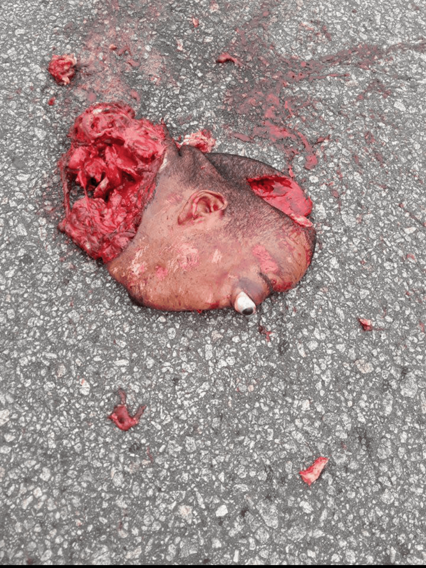 Decapitated head ran over