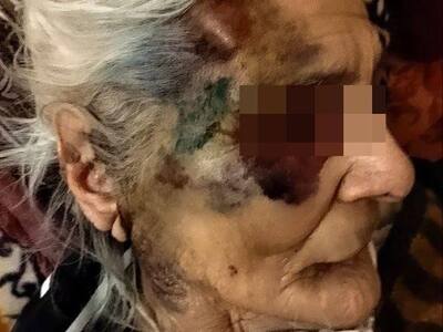 Pensioner was beaten in hospital
