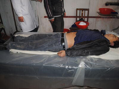 the autopsy of Chinese man