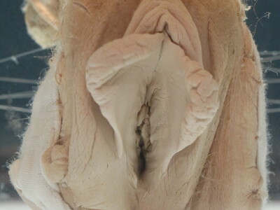 Chinese woman's pussy specimen