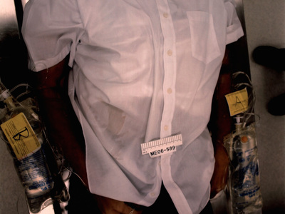 Photos from a Botched Lethal Injection