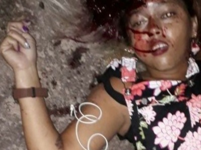 Colombian street hooker shoot dead