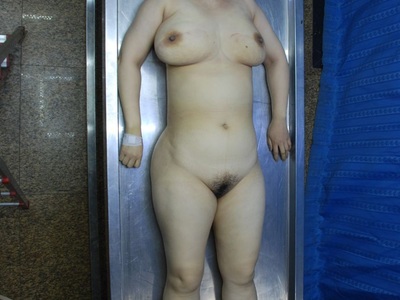 Chubby Chinese dead woman laying nude on the autopsy table 