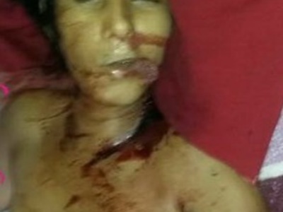 Nude woman killed in her bed by her husband.