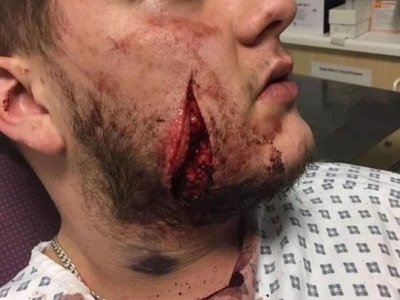 Man slashed in the face for his watch.
