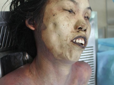 Examination nude dead corps of Chinese young women 