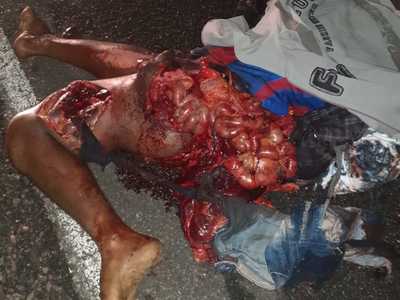 Brutal accident man totally shattered (photos) 