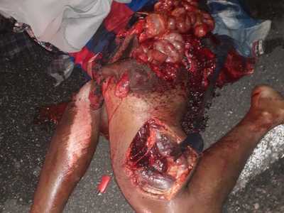 Brutal accident man totally shattered (photos) 