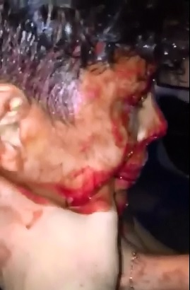 Desperate Man tries to Stop the Bleeding from his Friends Neck after Accident