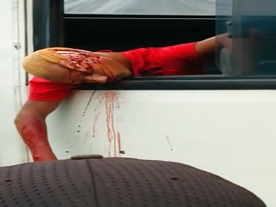 Bus accident, guy half scalped, looks dead.