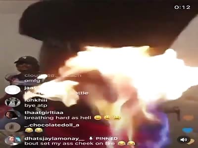 Dumb Bitch Sets Herself on Fire on IG Live.