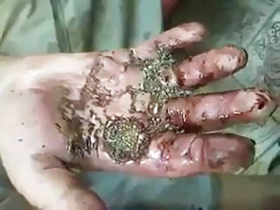 Putrid hand with worms - La Tía Del Gore 
