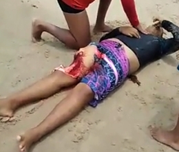 Man bit by shark in Brazil (Different angle)