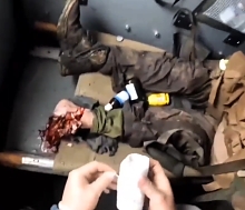 UA medics amputating limbs from a wounded UA soldier