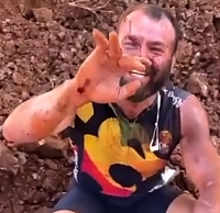 Cyclist shows his broken fingers after crash (Brazil)