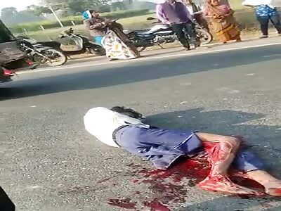 victim has skinned leg in accident