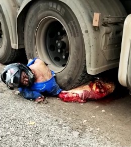 Poor crushed and dead biker