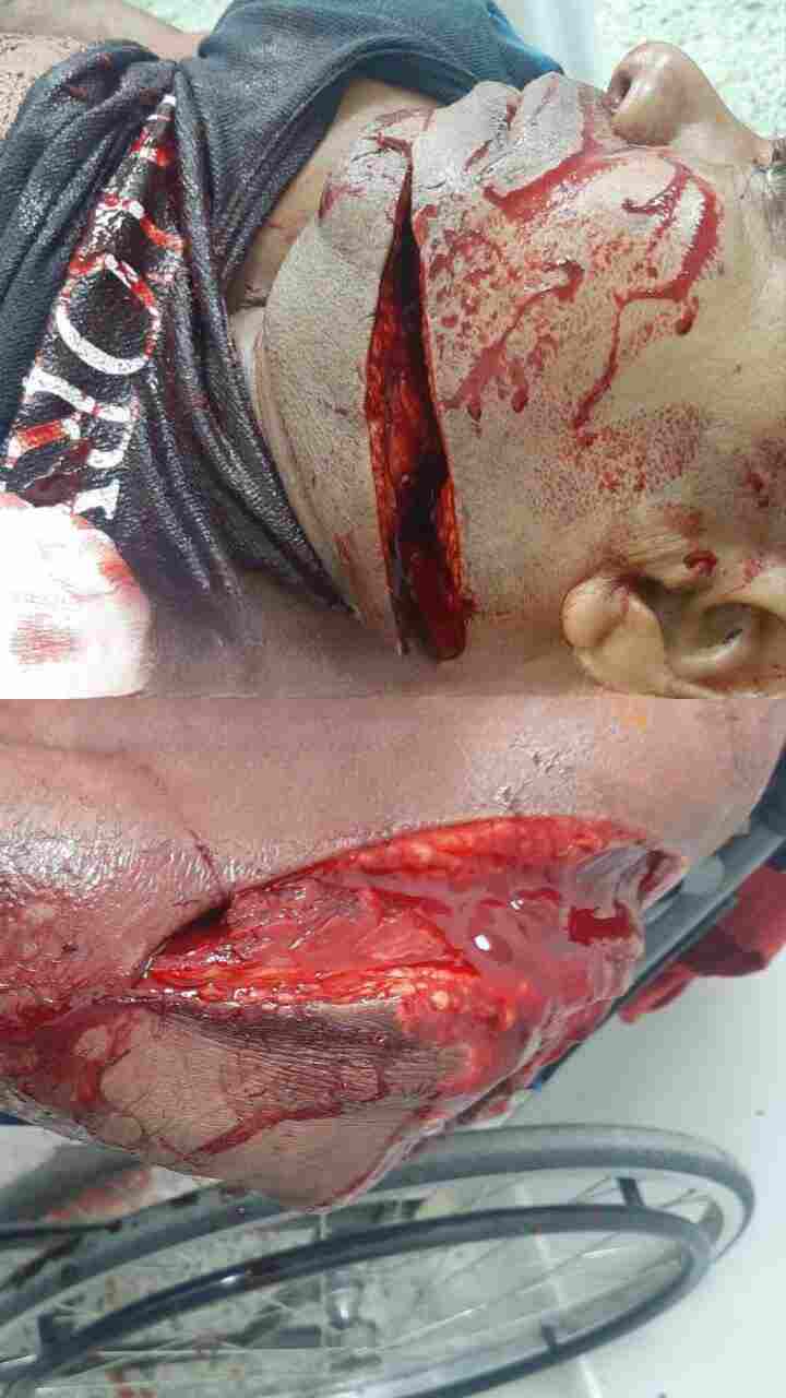 Retired Policeman Hacked Up Like a Piece of Raw Pork (Still Alive)