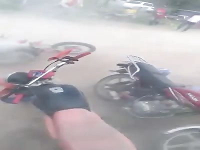 Dirt bike accident.