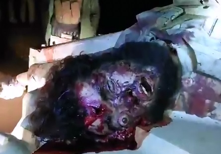 Dead ISIS Fighter with Eye Popping Out..Quite a Scary Face 