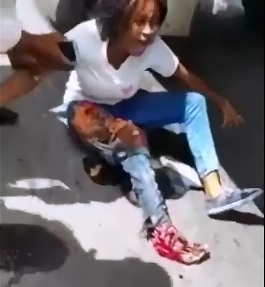 Screaming Woman is Desperate with Thing and Foot Ripped to Shreds 