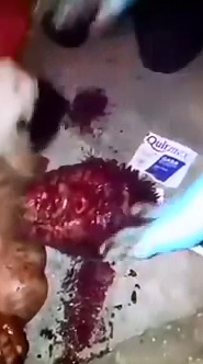 Groaning Man in a World of Shit with Disfiguring Knife Wound to the Face 