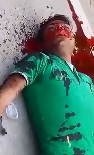 Kid drowning in his own blood after accident