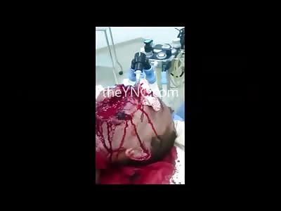 Ex-Girl put a Bullet from a Rifle in this Guys Face...Still Alive 
