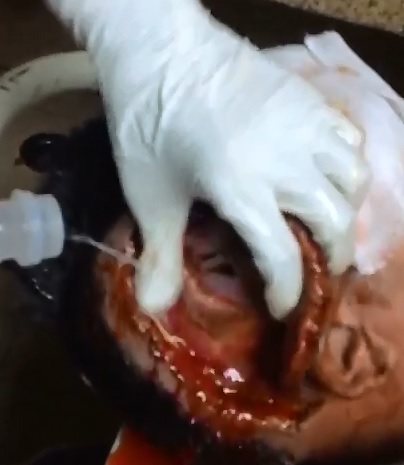 Shocl Video shows Man Scalped to the Skull and his Ear Ripped Off 