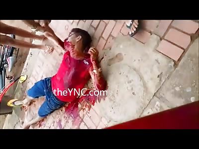 Boy Shot in the Head has Fountain of Blood Gushing from his Face as his GF Screams in Terror (First on Scene) 