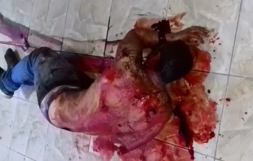 Wow...Very Hard Video shows Man Vomiting Blood Suffering after being Shot many times in the Back 