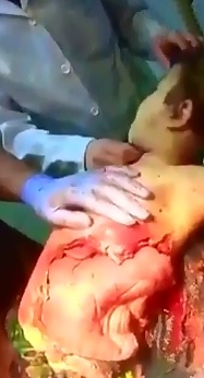 Poor Kid has some Weird Skin Infection that has Spread to his Internal Organs 