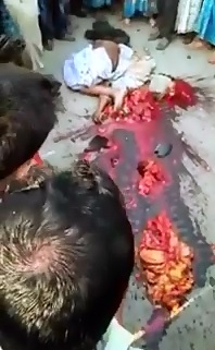 Onlookers Gawk at True Gore..Gruesome Remains of Man Dragged by Truck (Longer Version) 