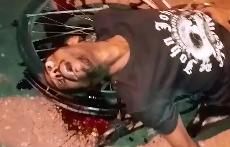 Epic Gore..Man with Eye Popped out of Skull takes his Final Breath on Camera 