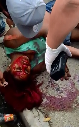 Dead Girl Covered in Blood is being Comforted before she Dies 