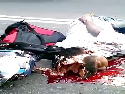 Motorbike rider's head crushed