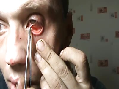 Crazy Russian guy extracts his eye