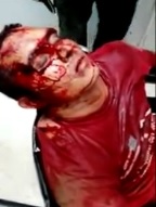 Dude Beaten Blood by His Wife for Cheating... Agonizing in Hospital