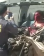 Disfigured guy trapped in the wreckage of a pickup stolen by him