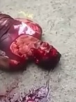 Thief Begs for Help Covered in Blood...Noone Helps