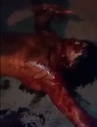 Drunk Man Bleeding out on Street (Machete Blow in the Face)