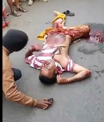 Dude Ran over and Crushed Still Alive Talking 