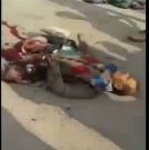 Dude Ripped Apart in Total Agony After Accident