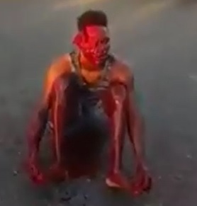 Man in Shock has His Face Literally Skinned after Accident..Sits Patiently on the Street 