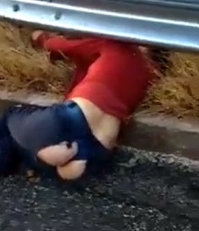 Great Aftermath Shows Woman Ass Exposed after Road Rash