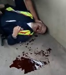 Security Guard Bleeding out In Agony After Being Hit with a Rock